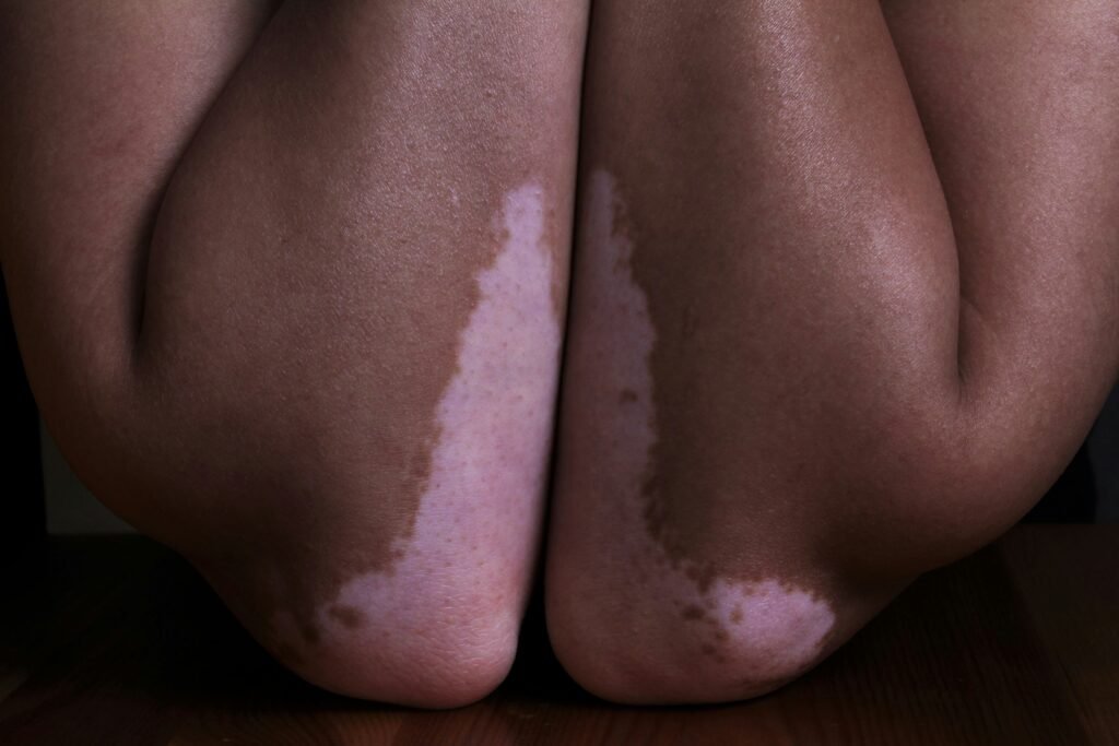 Corpo e trauma: o que o corpo diz quando a mente silencia