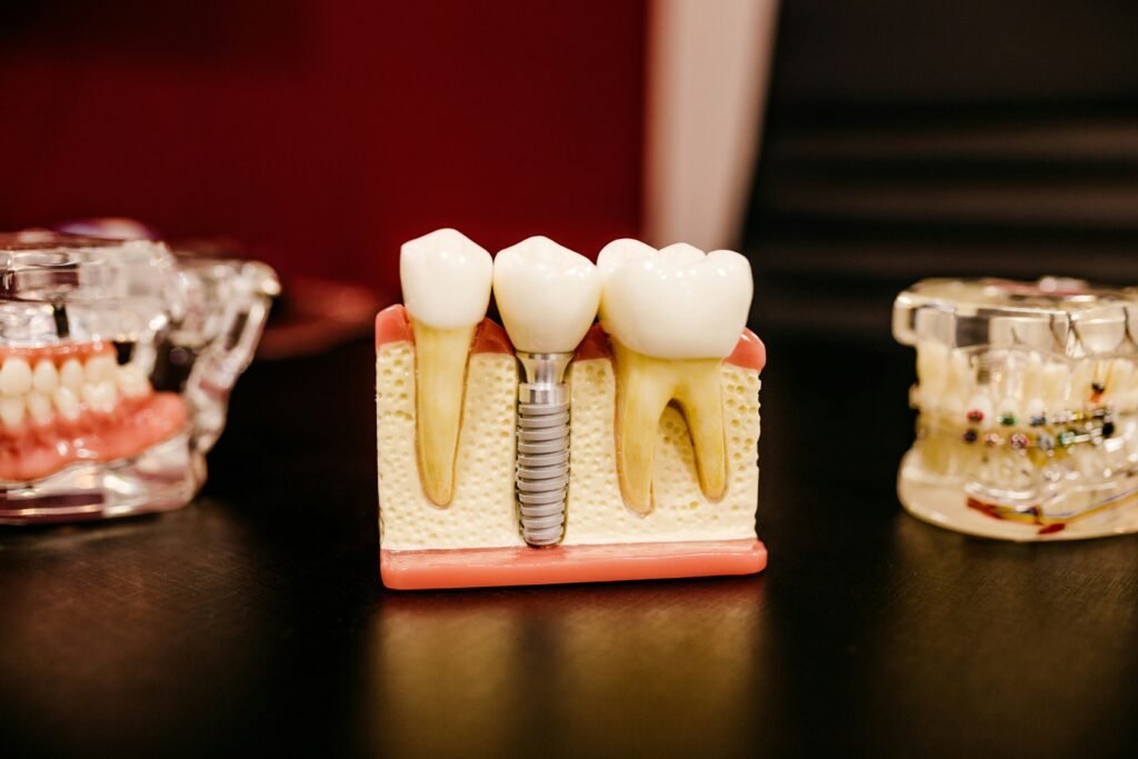 Medicina chinesa, emoções e a cartografia energética dos dentes: uma leitura ampliada da saúde.